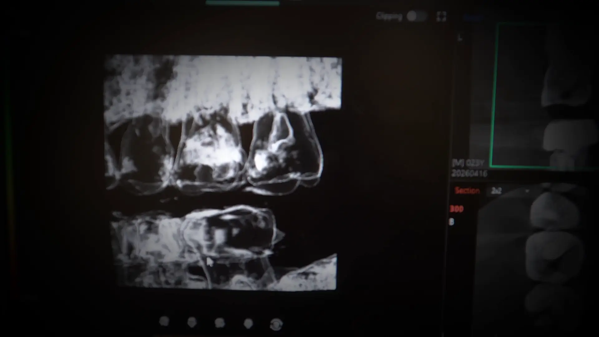 Play video